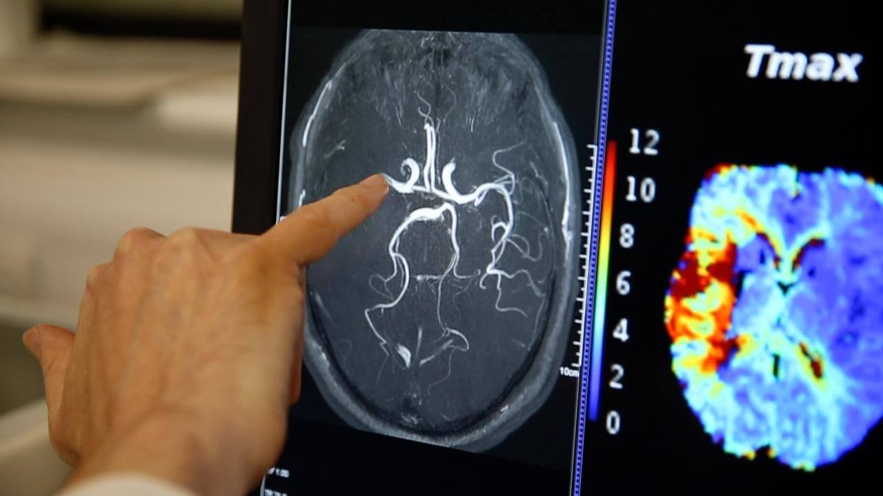 Brain scan image