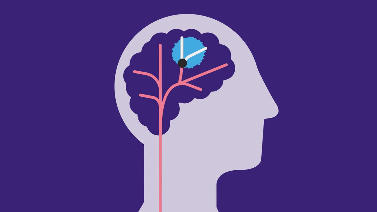 Illustration showing an ischaemic stroke