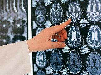 finger pointing at brain scans