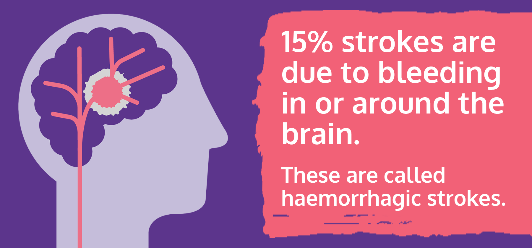 Hemorrhagic stroke info-graphic by the stroke association