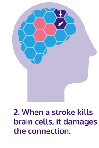 Neuroplasticity diagram two