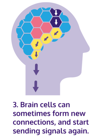 Neuroplasticity diagram three